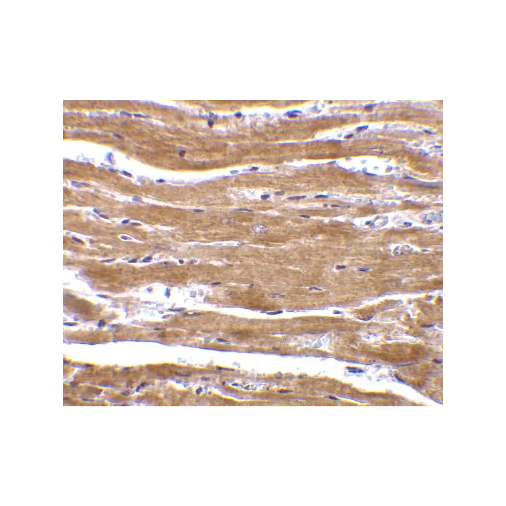 ProSci 2247 BACE2 Antibody, ProSci, 0.1 mg/Unit Secondary Image