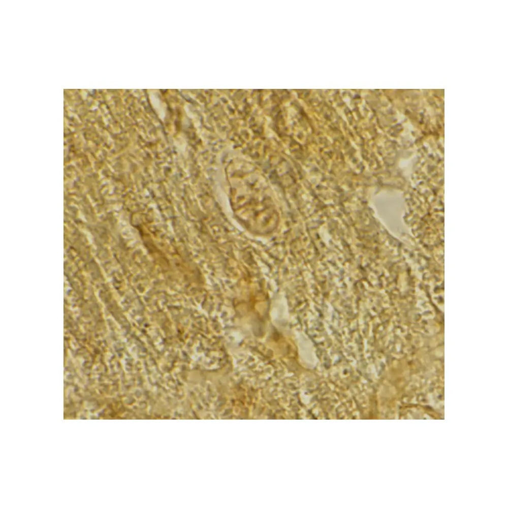 ProSci 2249_S BACE2 Antibody, ProSci, 0.02 mg/Unit Secondary Image