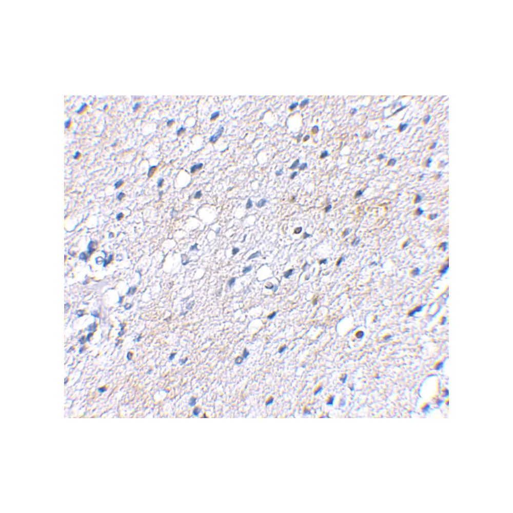 ProSci 4503_S BAP3 Antibody, ProSci, 0.02 mg/Unit Secondary Image