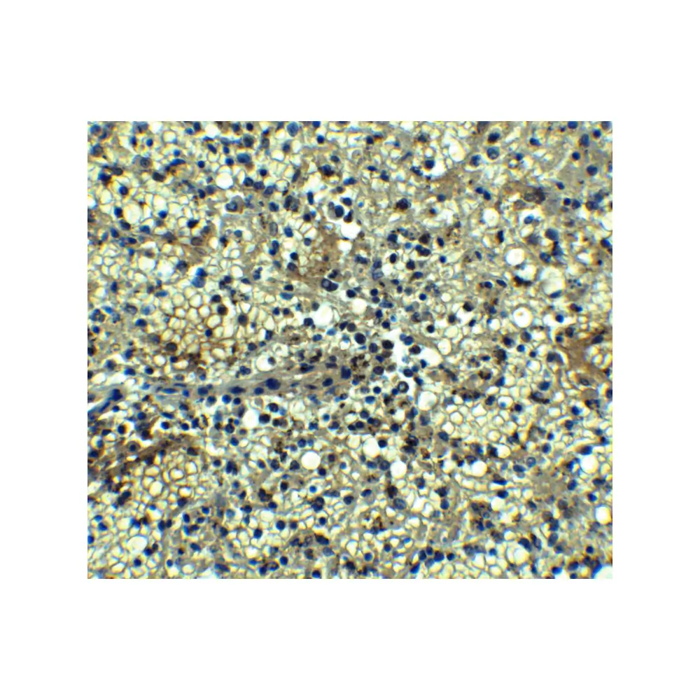 ProSci 2397_S BCMA Antibody, ProSci, 0.02 mg/Unit Secondary Image