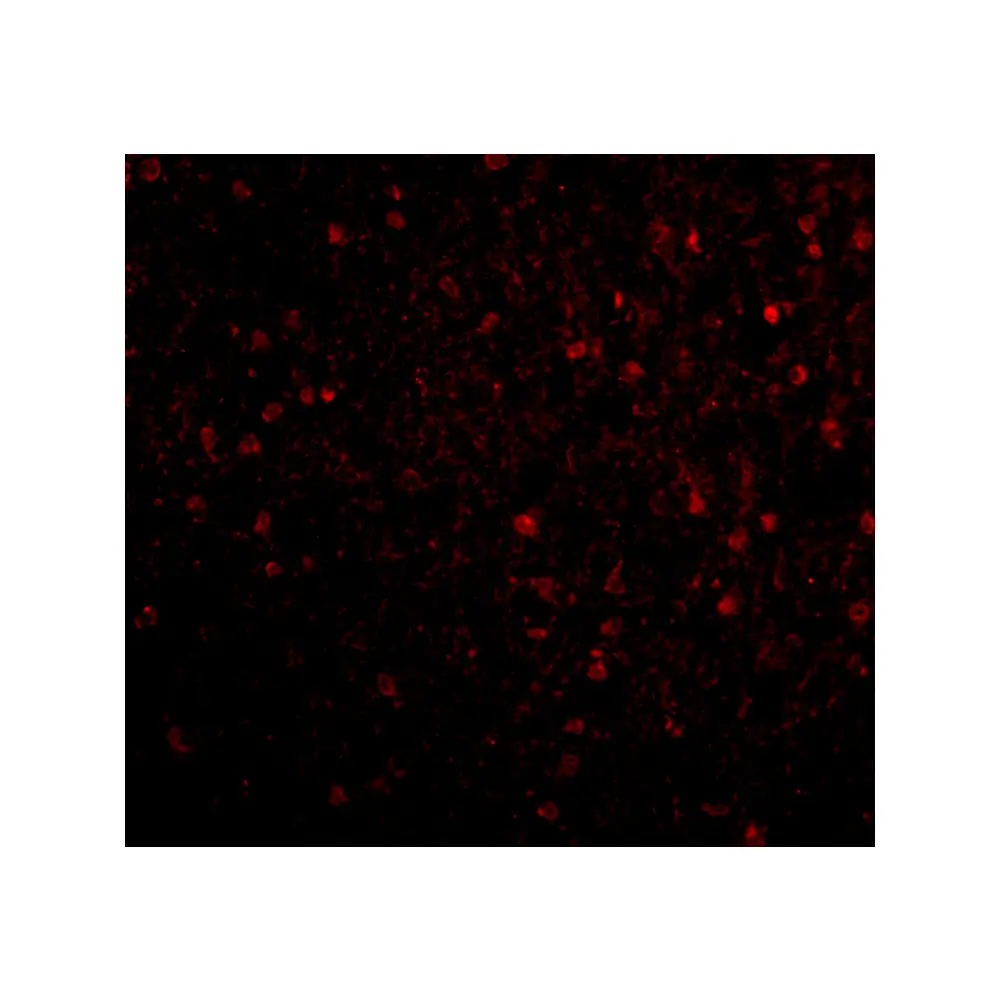 ProSci 4085_S BRSK2 Antibody, ProSci, 0.02 mg/Unit Tertiary Image