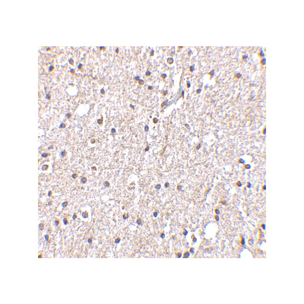 ProSci 4085_S BRSK2 Antibody, ProSci, 0.02 mg/Unit Secondary Image