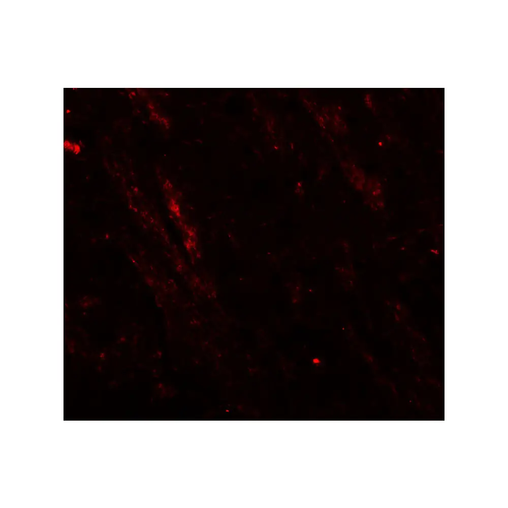 ProSci 8029 CACNA1H Antibody, ProSci, 0.1 mg/Unit Tertiary Image