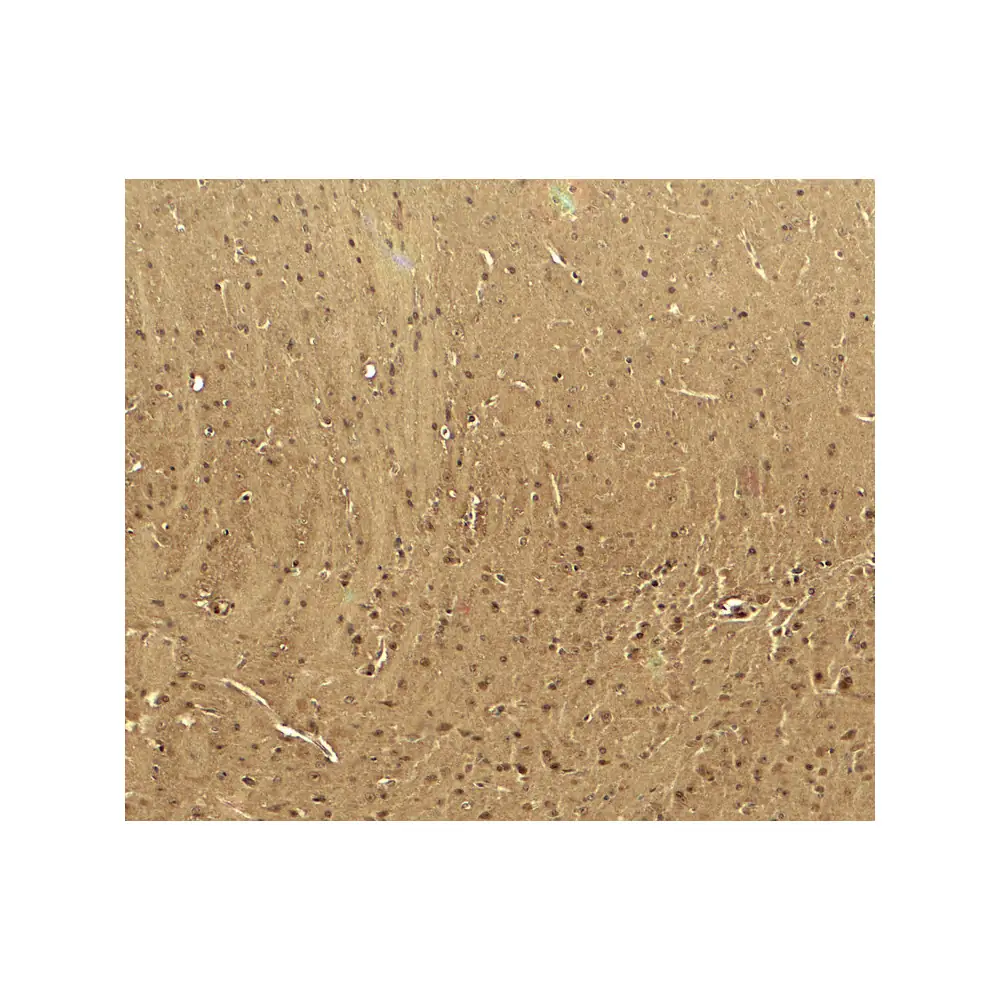 ProSci 8029 CACNA1H Antibody, ProSci, 0.1 mg/Unit Secondary Image