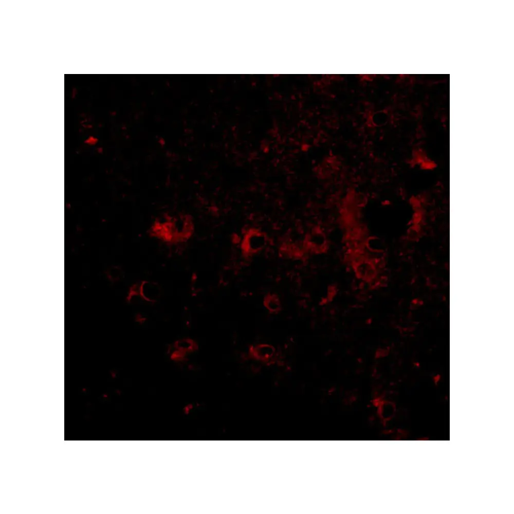 ProSci 4565_S CAPS2 Antibody, ProSci, 0.02 mg/Unit Tertiary Image