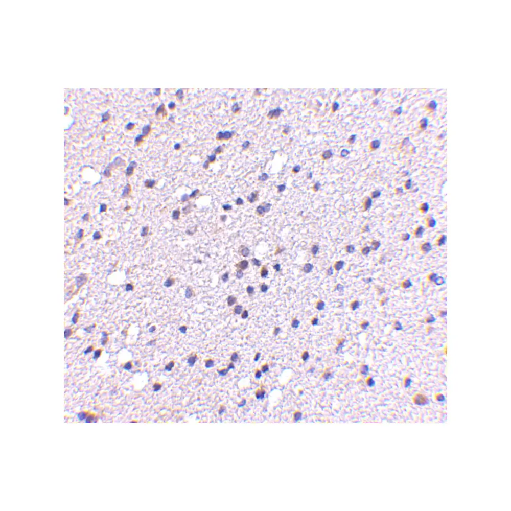 ProSci 4565_S CAPS2 Antibody, ProSci, 0.02 mg/Unit Secondary Image