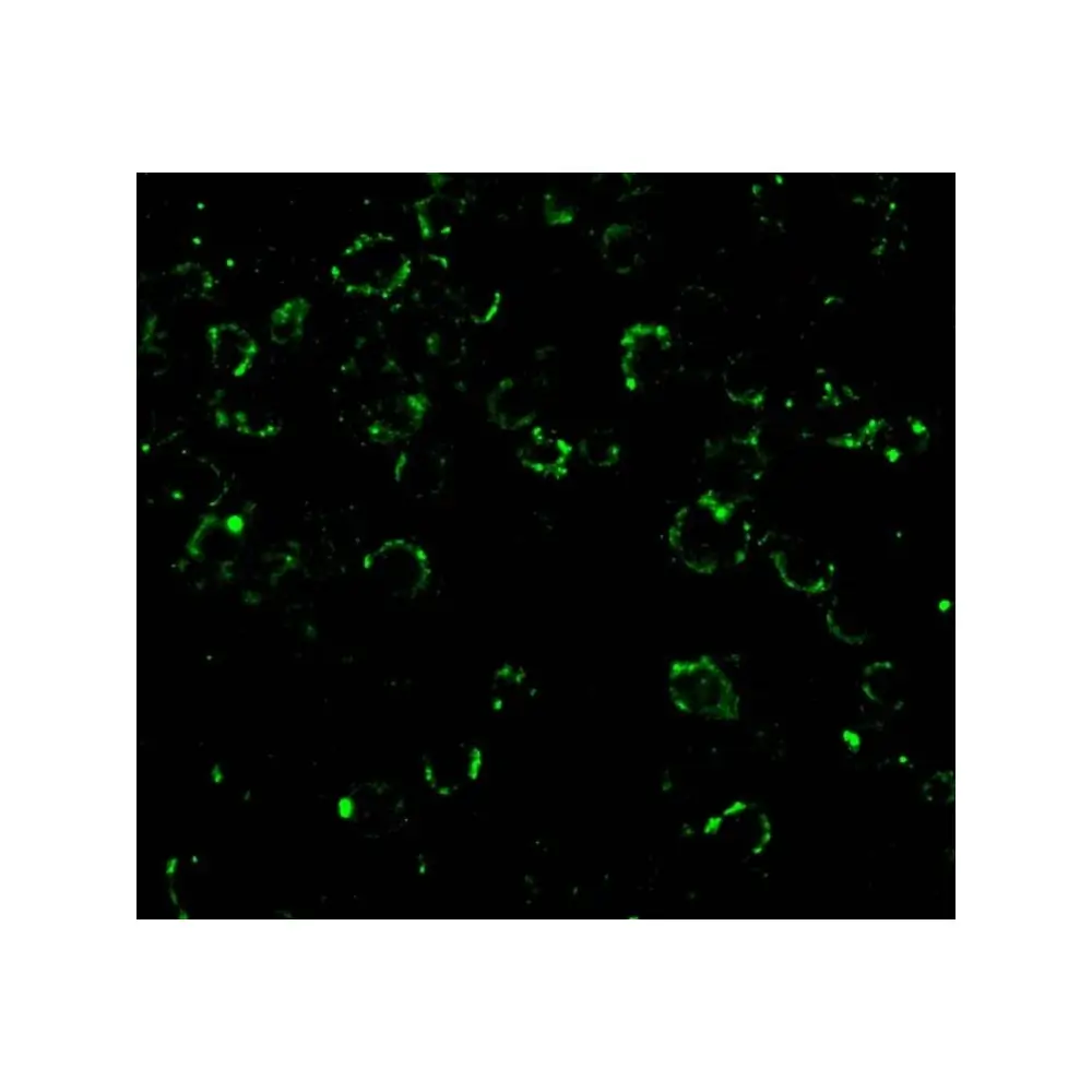 ProSci 3013 CARD10 Antibody, ProSci, 0.1 mg/Unit Tertiary Image