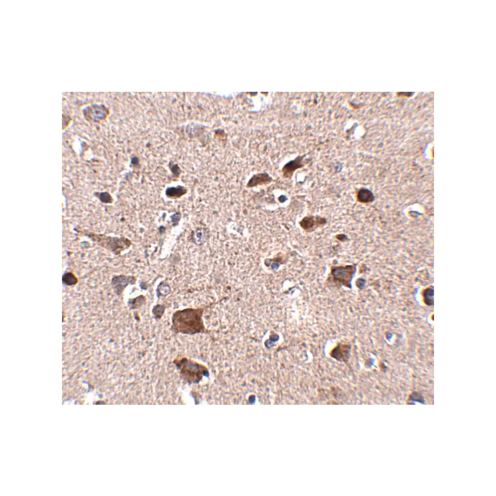 ProSci 5265_S CCDC134 Antibody, ProSci, 0.02 mg/Unit Secondary Image