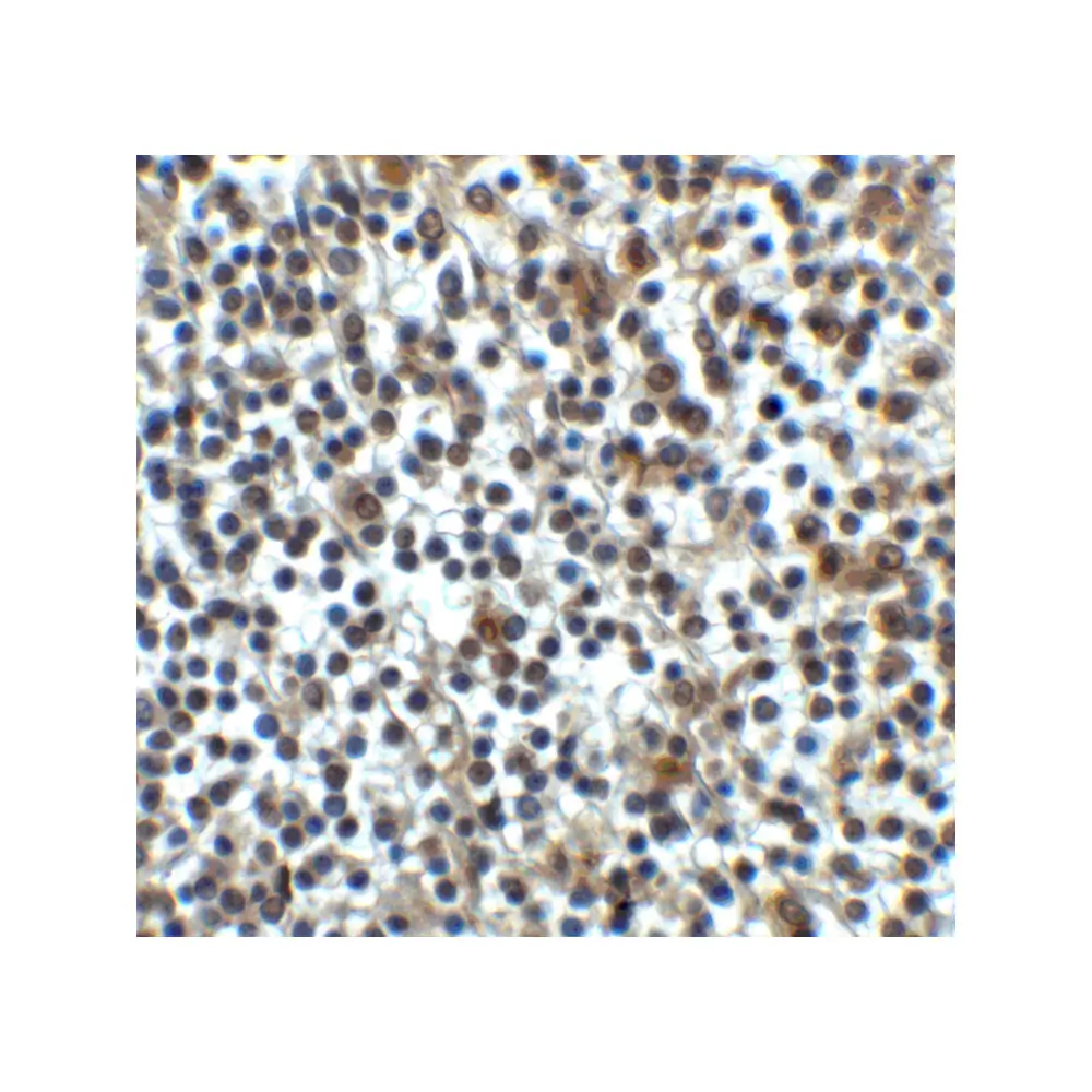 ProSci 8689_S CD276 Antibody, ProSci, 0.02 mg/Unit Secondary Image