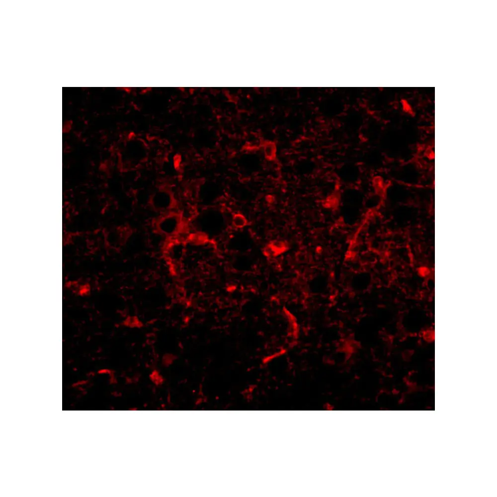 ProSci 5047 CDIP Antibody, ProSci, 0.1 mg/Unit Tertiary Image