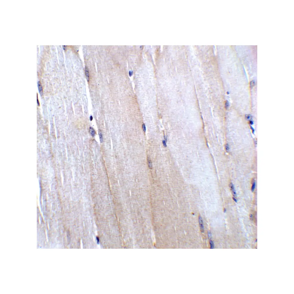 ProSci 8423 CHADL Antibody, ProSci, 0.1 mg/Unit Quaternary Image