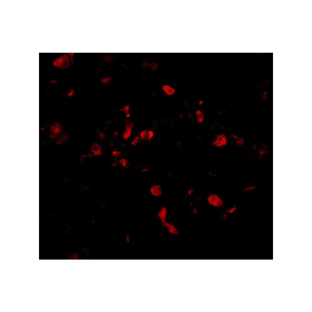 ProSci 2499_S CIKS Antibody, ProSci, 0.02 mg/Unit Tertiary Image