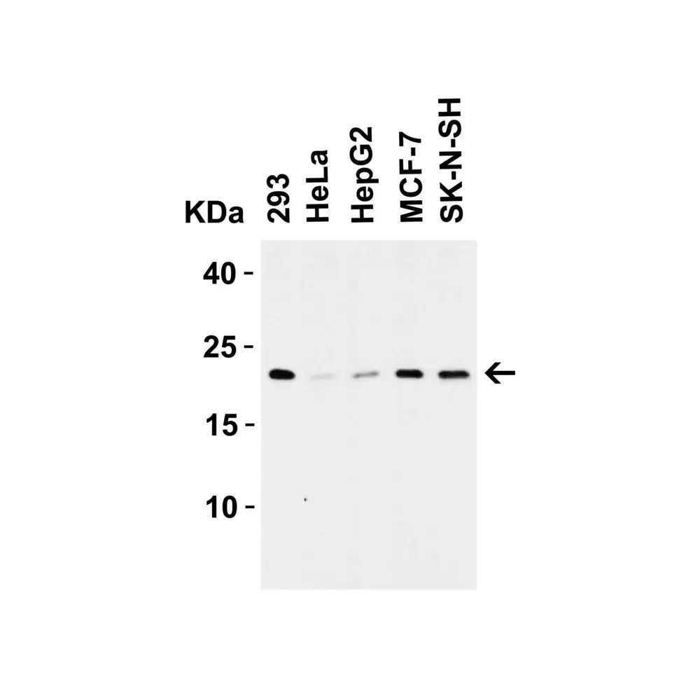 ProSci 7025 CLAUDIN4 Antibody, ProSci, 0.1 mg/Unit Secondary Image