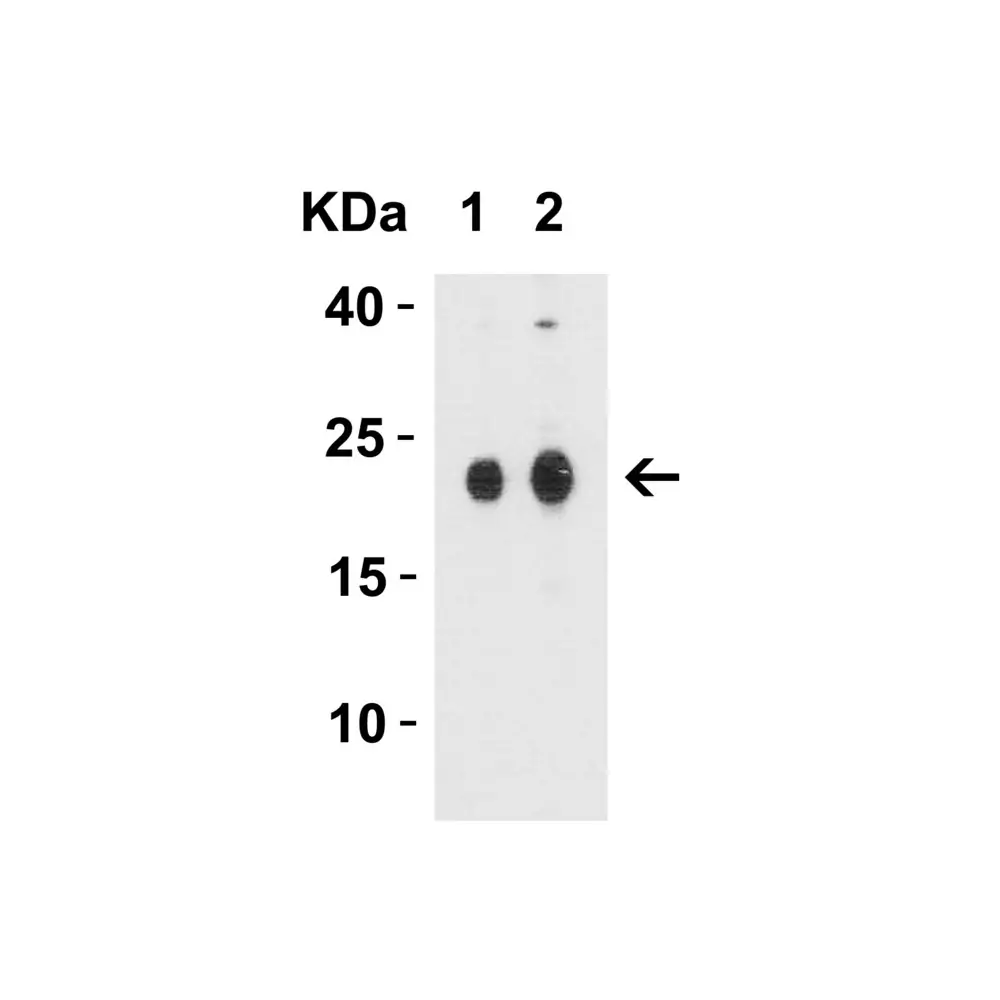 ProSci 7025 CLAUDIN4 Antibody, ProSci, 0.1 mg/Unit Tertiary Image