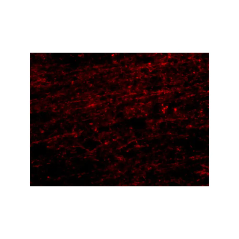 ProSci 4659_S CLIP170 Antibody, ProSci, 0.02 mg/Unit Secondary Image