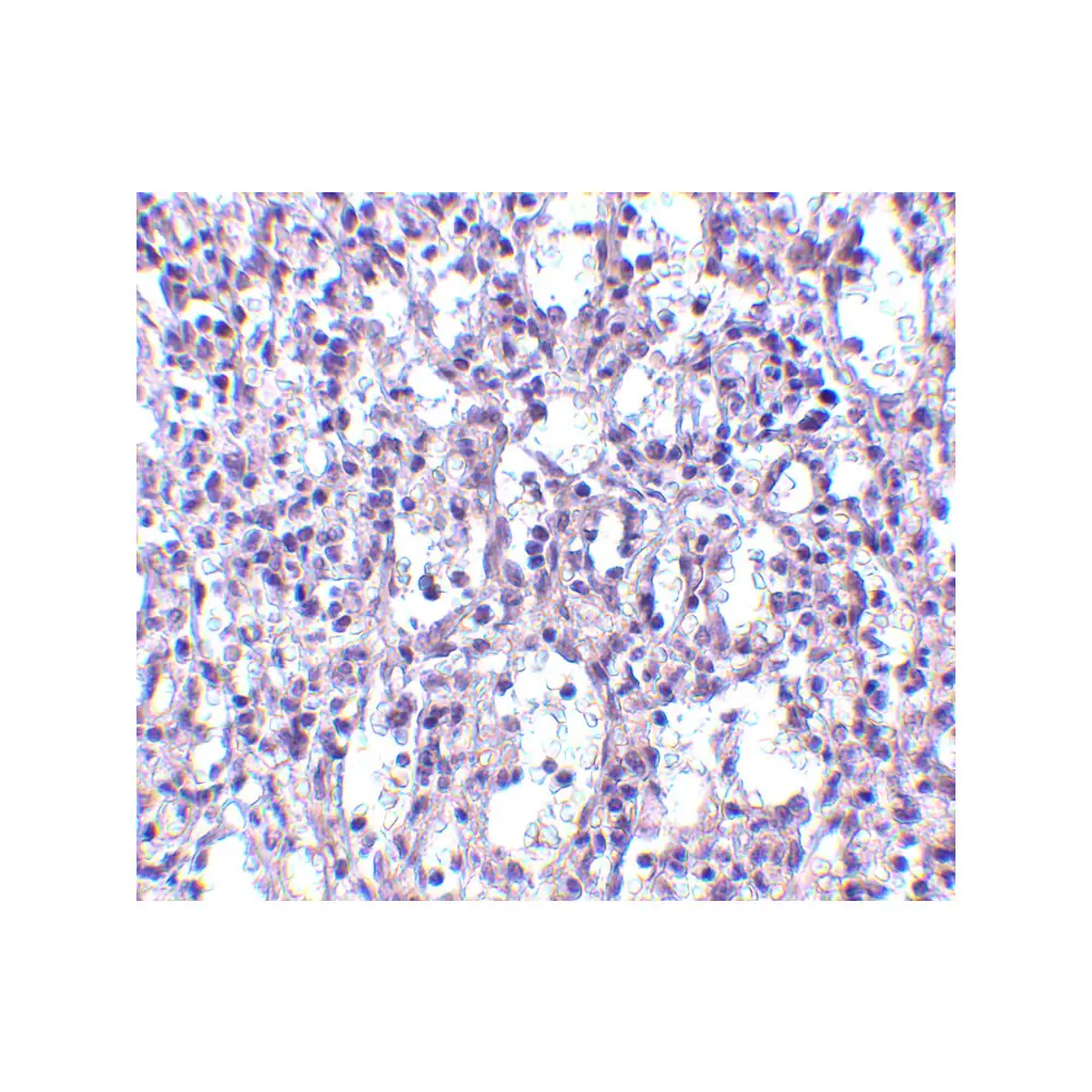 ProSci 4269_S Carabin Antibody, ProSci, 0.02 mg/Unit Secondary Image