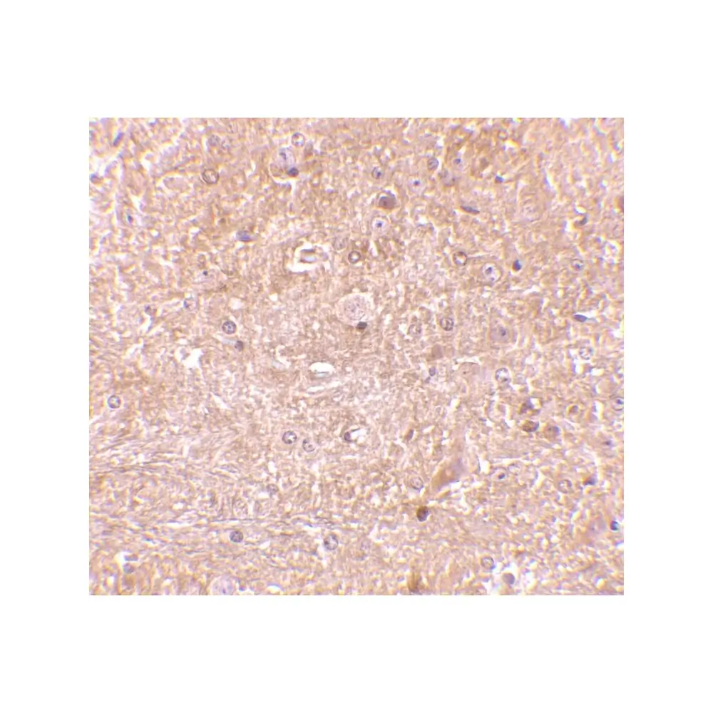 ProSci 2245_S Caspase-13 Antibody, ProSci, 0.02 mg/Unit Secondary Image