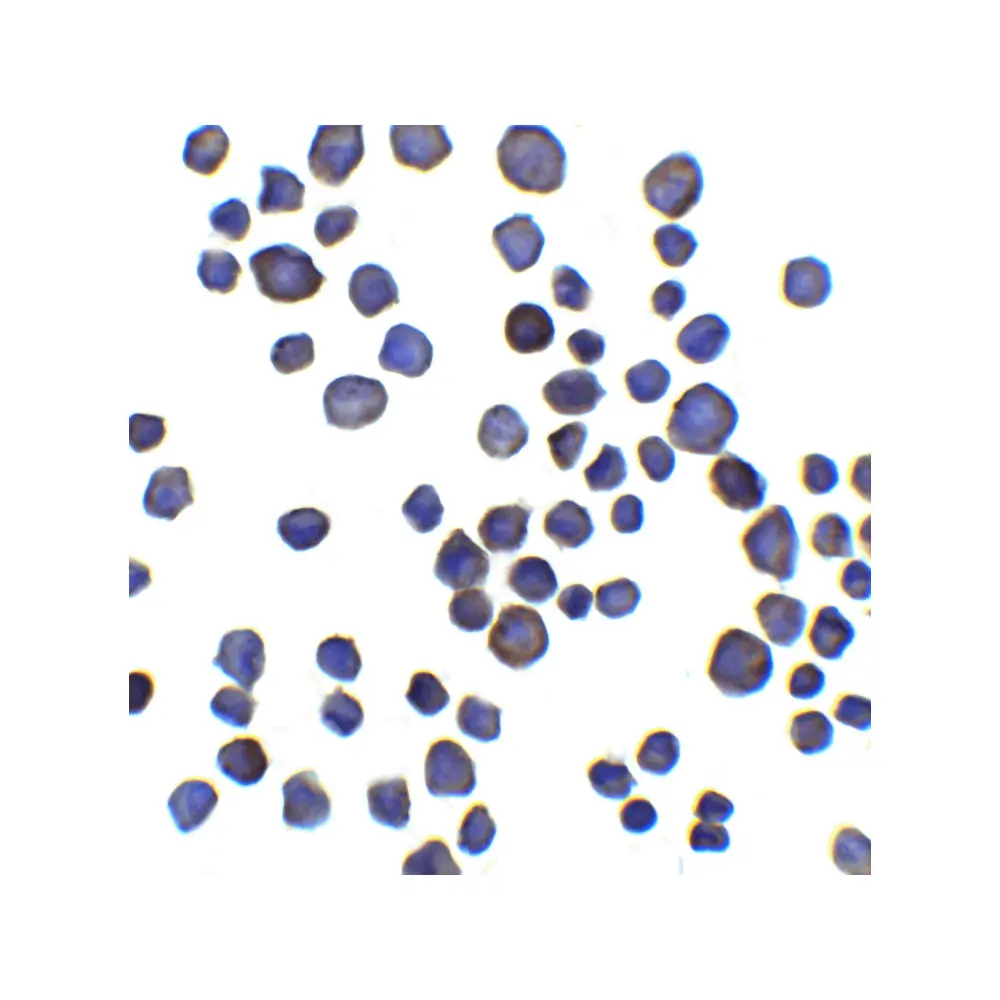 ProSci 8421_S Chondroadherin Antibody, ProSci, 0.02 mg/Unit Primary Image