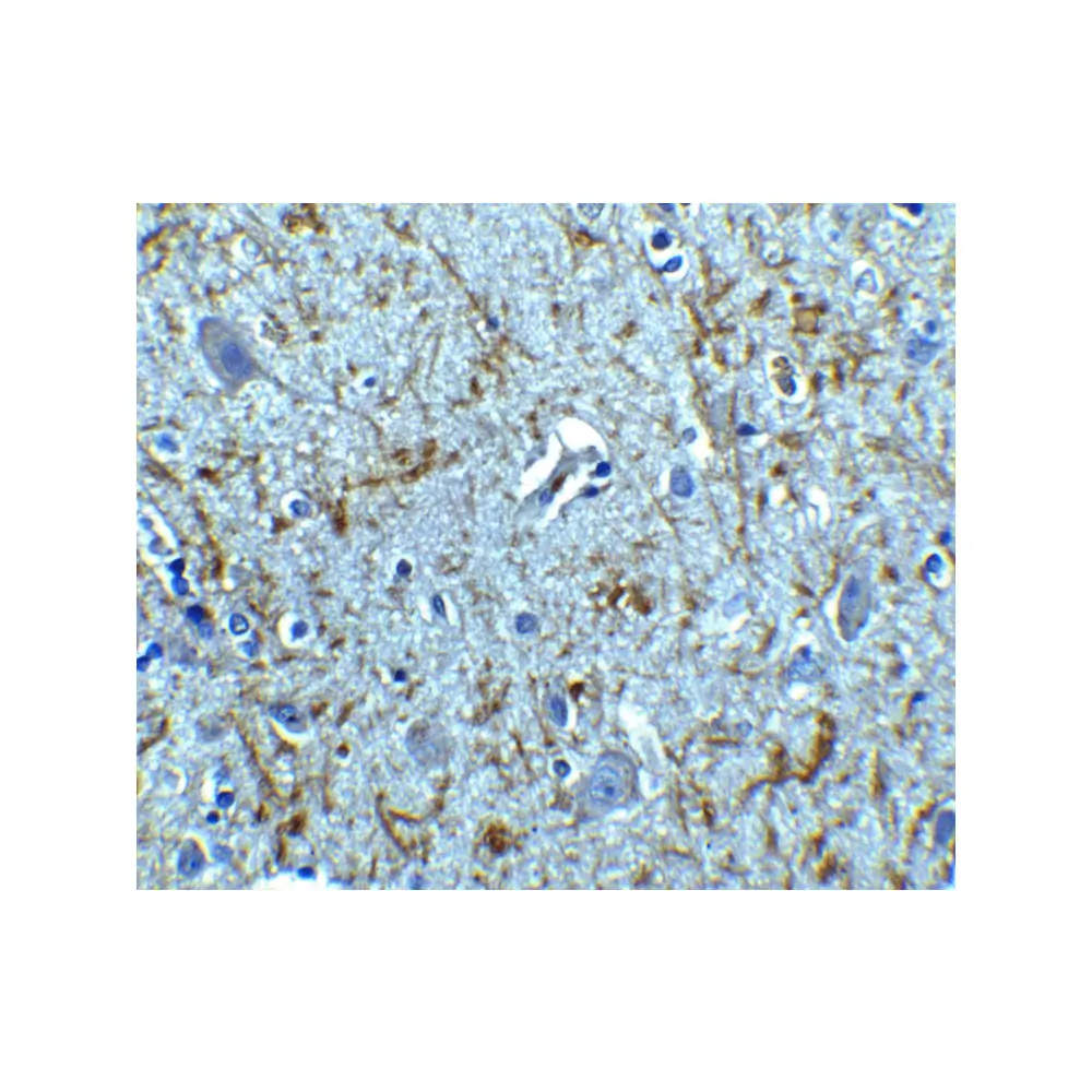 ProSci 3856_S Clusterin Antibody, ProSci, 0.02 mg/Unit Secondary Image