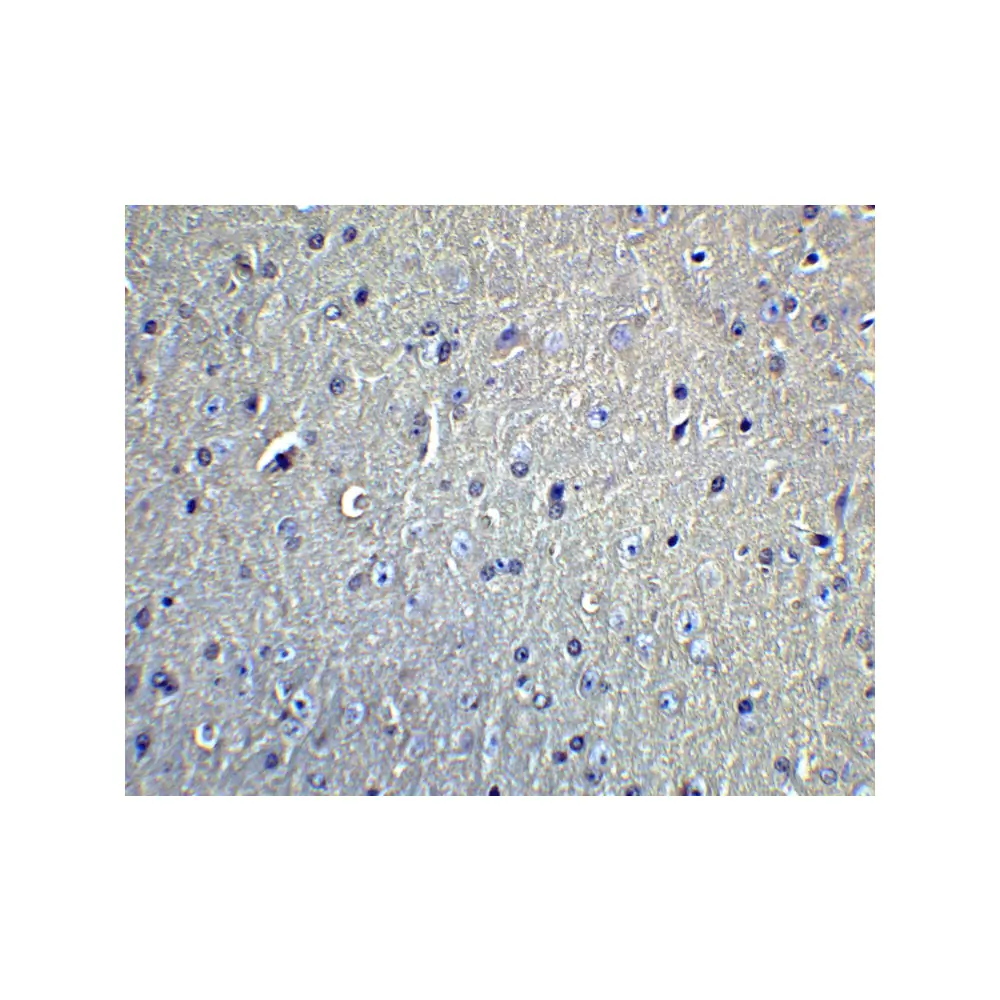 ProSci 5633 DCLK1 Antibody, ProSci, 0.1 mg/Unit Quaternary Image