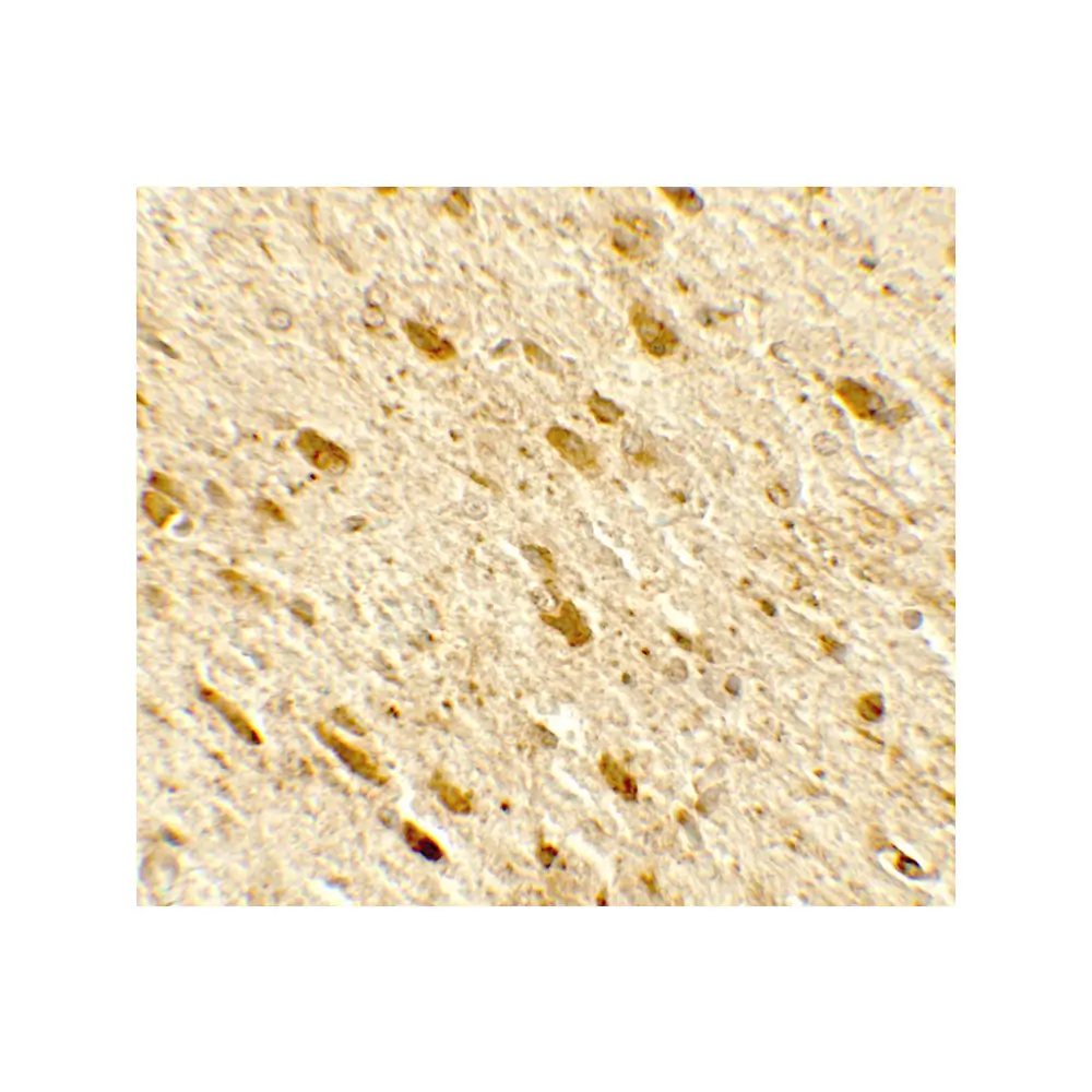 ProSci 7755_S DENR Antibody, ProSci, 0.02 mg/Unit Secondary Image