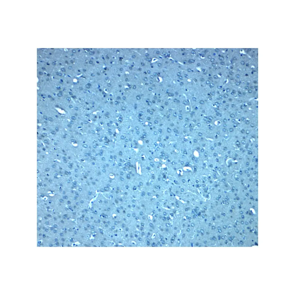 ProSci 8347_S DIS3L2 Antibody, ProSci, 0.02 mg/Unit Secondary Image