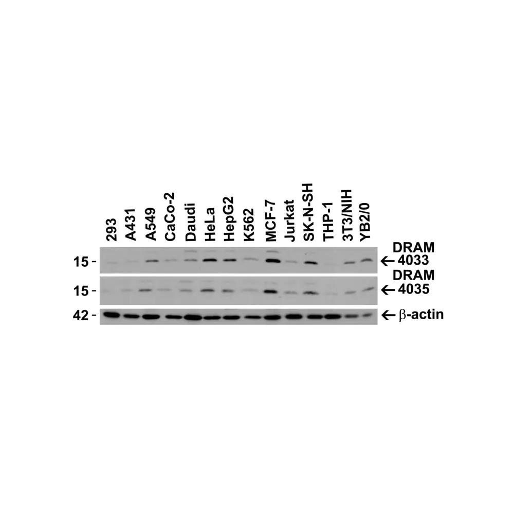 ProSci 4035_S DRAM Antibody, ProSci, 0.02 mg/Unit Secondary Image