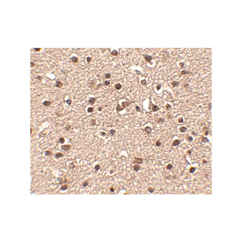 ProSci 4859 Dact2 Antibody, ProSci, 0.1 mg/Unit Secondary Image