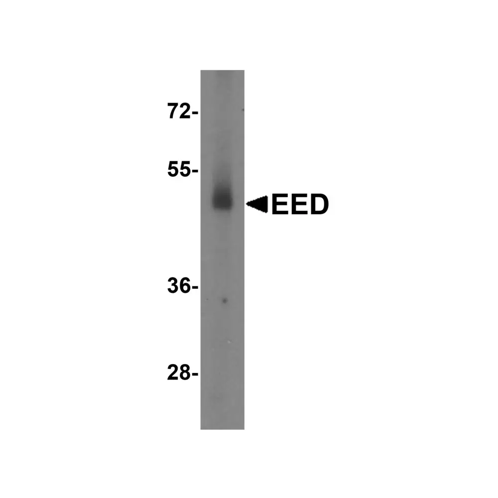 ProSci 7009 EED Antibody, ProSci, 0.1 mg/Unit Tertiary Image