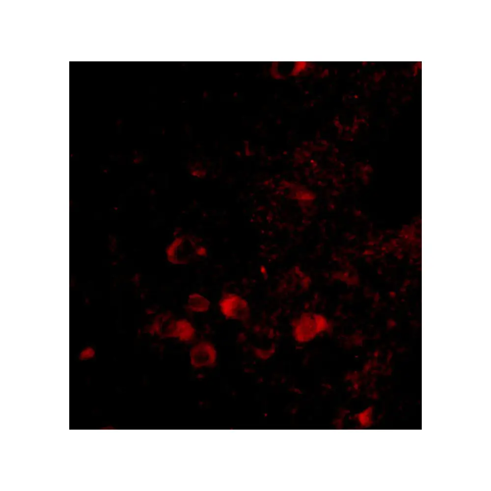 ProSci 4571 ELOVL6 Antibody, ProSci, 0.1 mg/Unit Tertiary Image