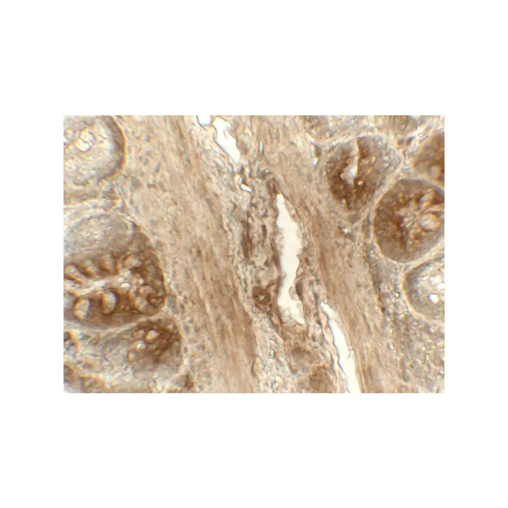 ProSci 8211 ERp72 Antibody, ProSci, 0.1 mg/Unit Secondary Image