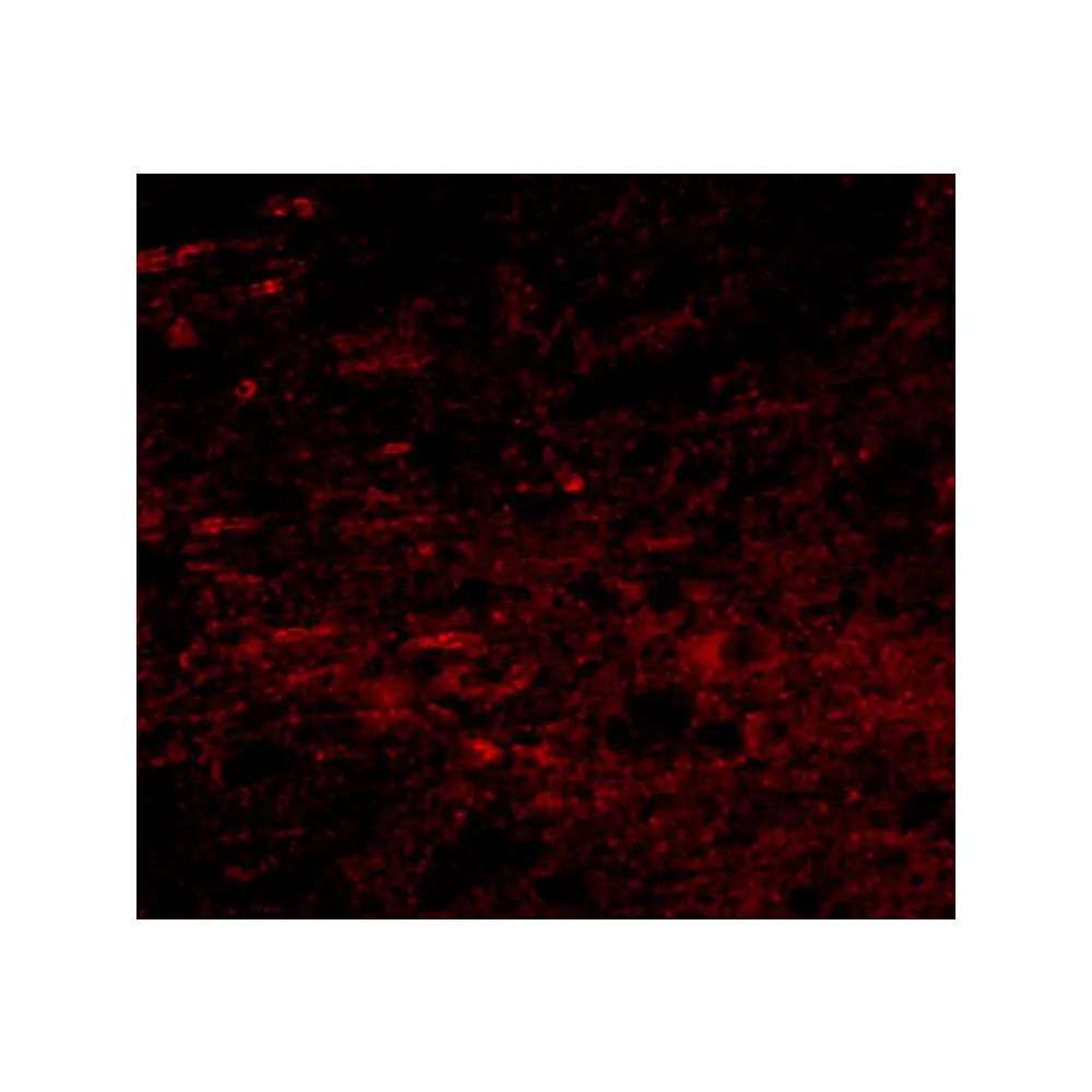 ProSci 5281 GALNT10 Antibody, ProSci, 0.1 mg/Unit Tertiary Image