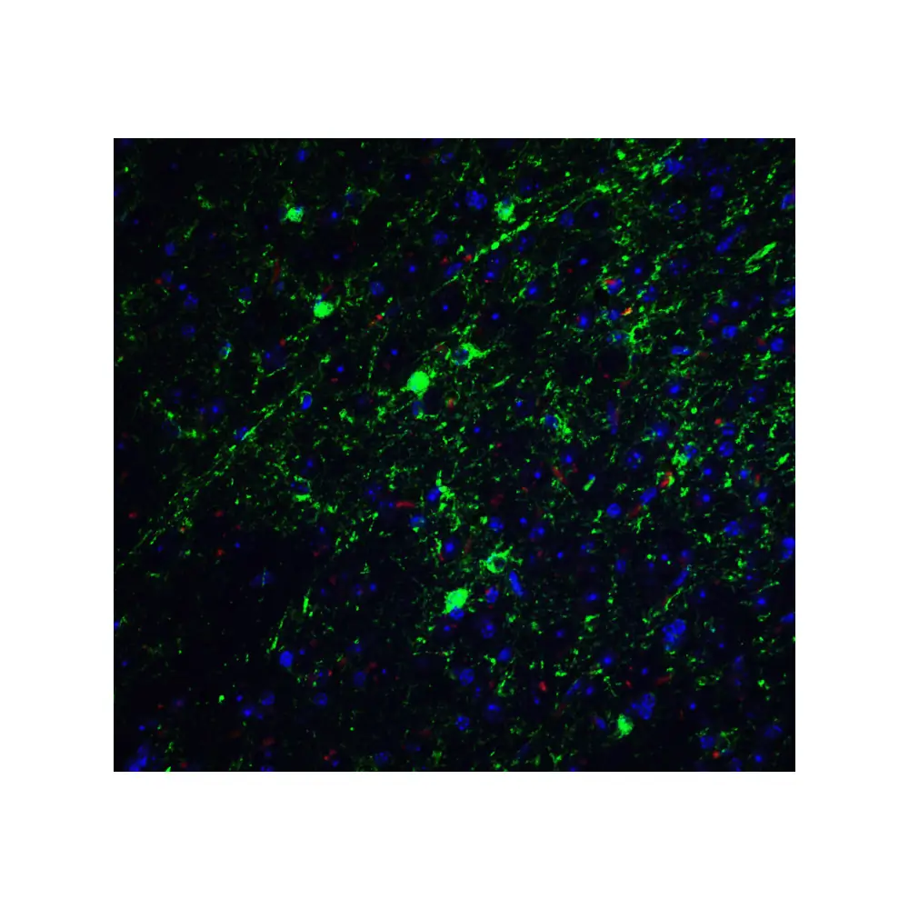 ProSci PM-7209_S GLUL Monoclonal Antibody, ProSci, 0.02 mg/Unit Tertiary Image