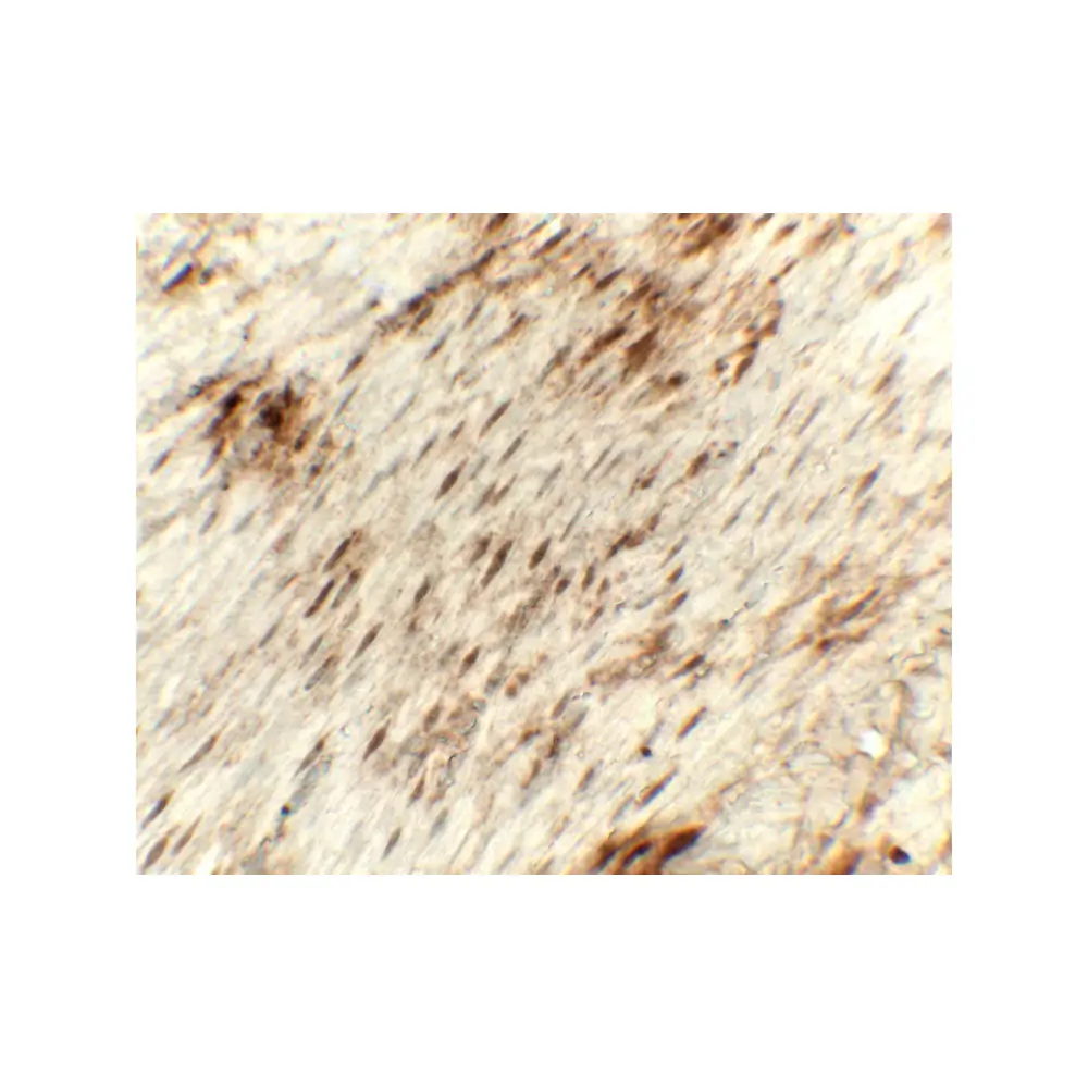 ProSci 8215 GOLGIN97 Antibody, ProSci, 0.1 mg/Unit Secondary Image