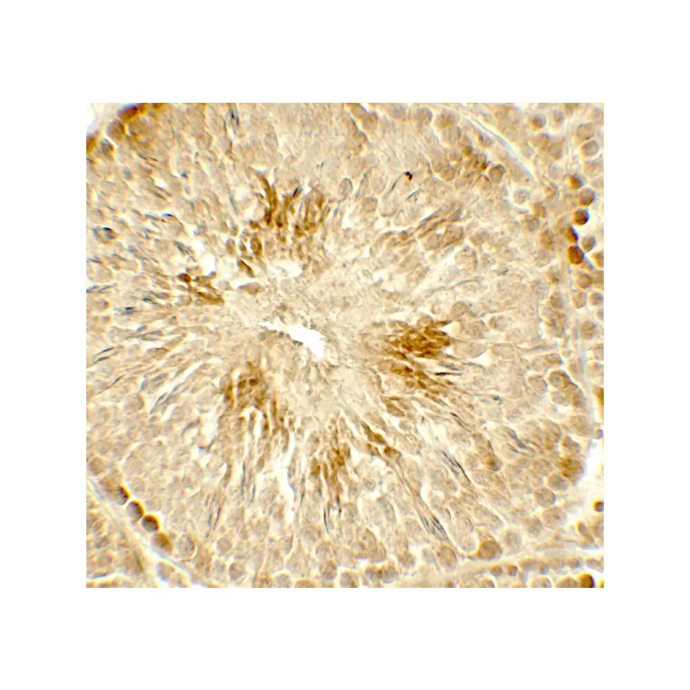 ProSci 7899 HDAC2 Antibody, ProSci, 0.1 mg/Unit Secondary Image