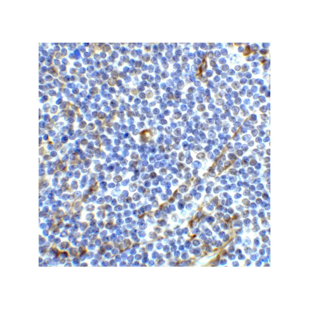 ProSci 8685 ICOS Antibody, ProSci, 0.1 mg/Unit Primary Image