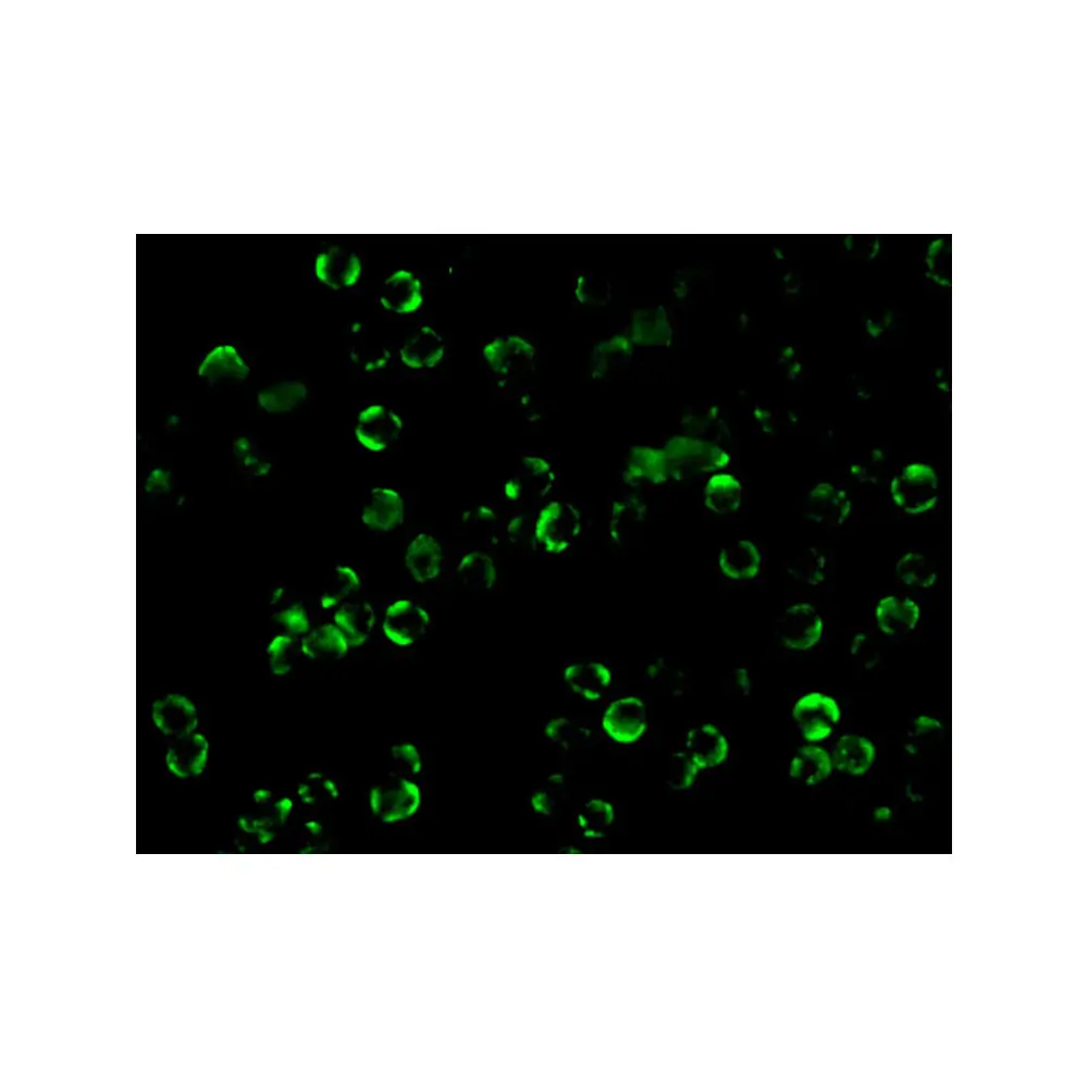 ProSci 2121 IKK beta Antibody, ProSci, 0.1 mg/Unit Tertiary Image