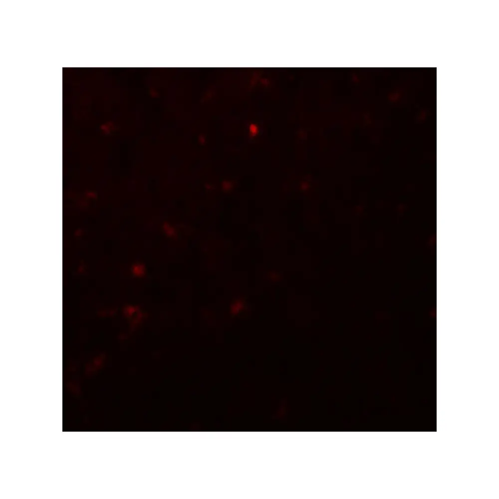 ProSci 8117_S IKZF2 Antibody, ProSci, 0.02 mg/Unit Tertiary Image