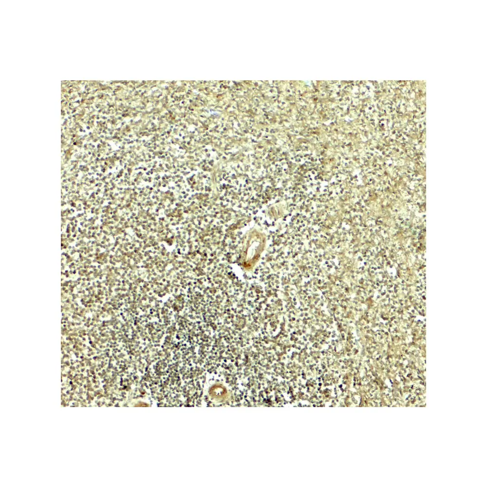 ProSci 8117_S IKZF2 Antibody, ProSci, 0.02 mg/Unit Secondary Image