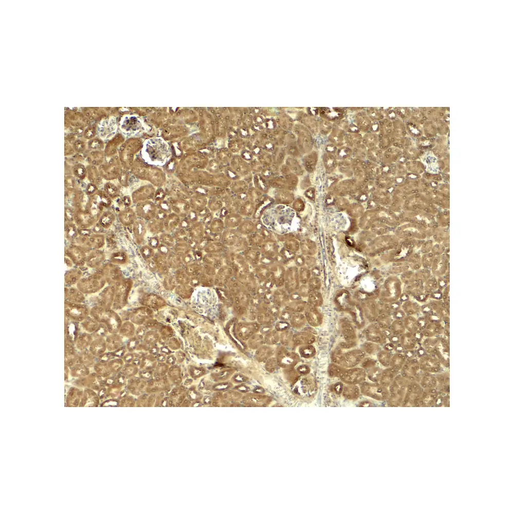 ProSci 8085_S JAK2 Antibody, ProSci, 0.02 mg/Unit Secondary Image