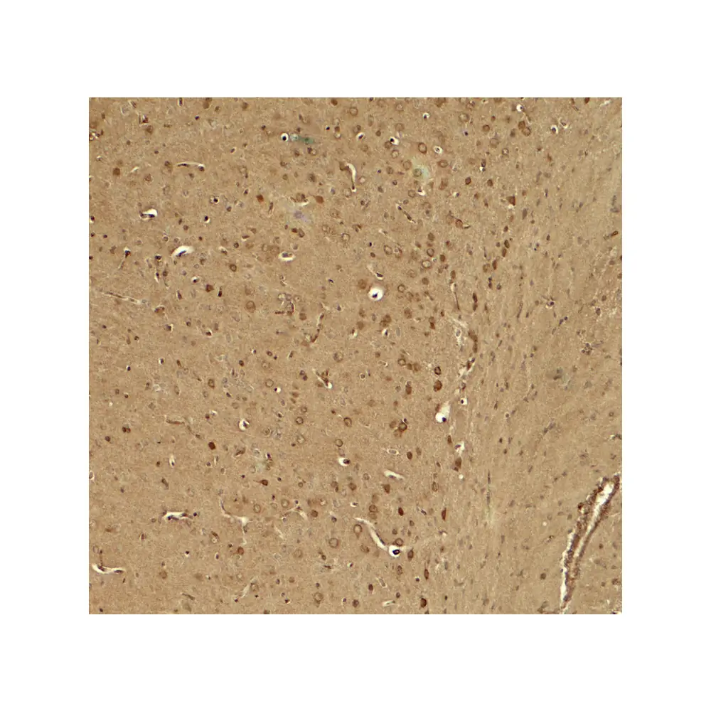 ProSci 8017 KCNK1 Antibody, ProSci, 0.1 mg/Unit Secondary Image