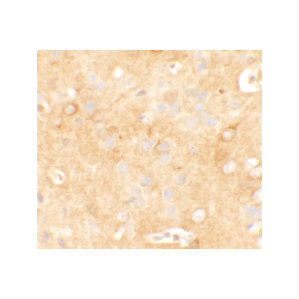 ProSci 6425 KCNK12 Antibody, ProSci, 0.1 mg/Unit Secondary Image