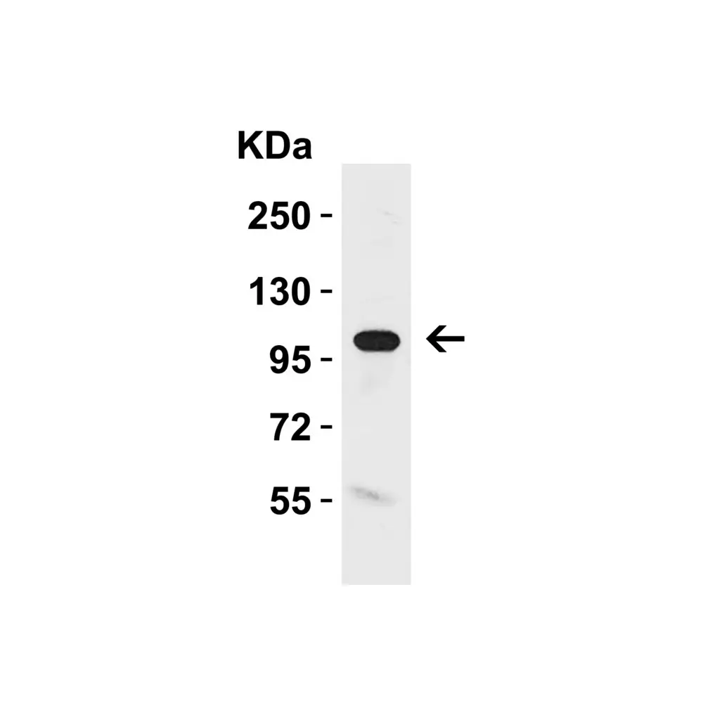 ProSci 6107 KLOTHO Antibody, ProSci, 0.1 mg/Unit Tertiary Image