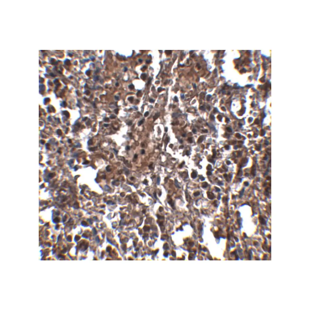 ProSci 5017 KLRA2 Antibody, ProSci, 0.1 mg/Unit Secondary Image