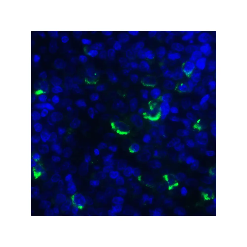 ProSci RF16061 LIGHT Antibody [7B9F12], ProSci, 0.1 mg/Unit Quaternary Image