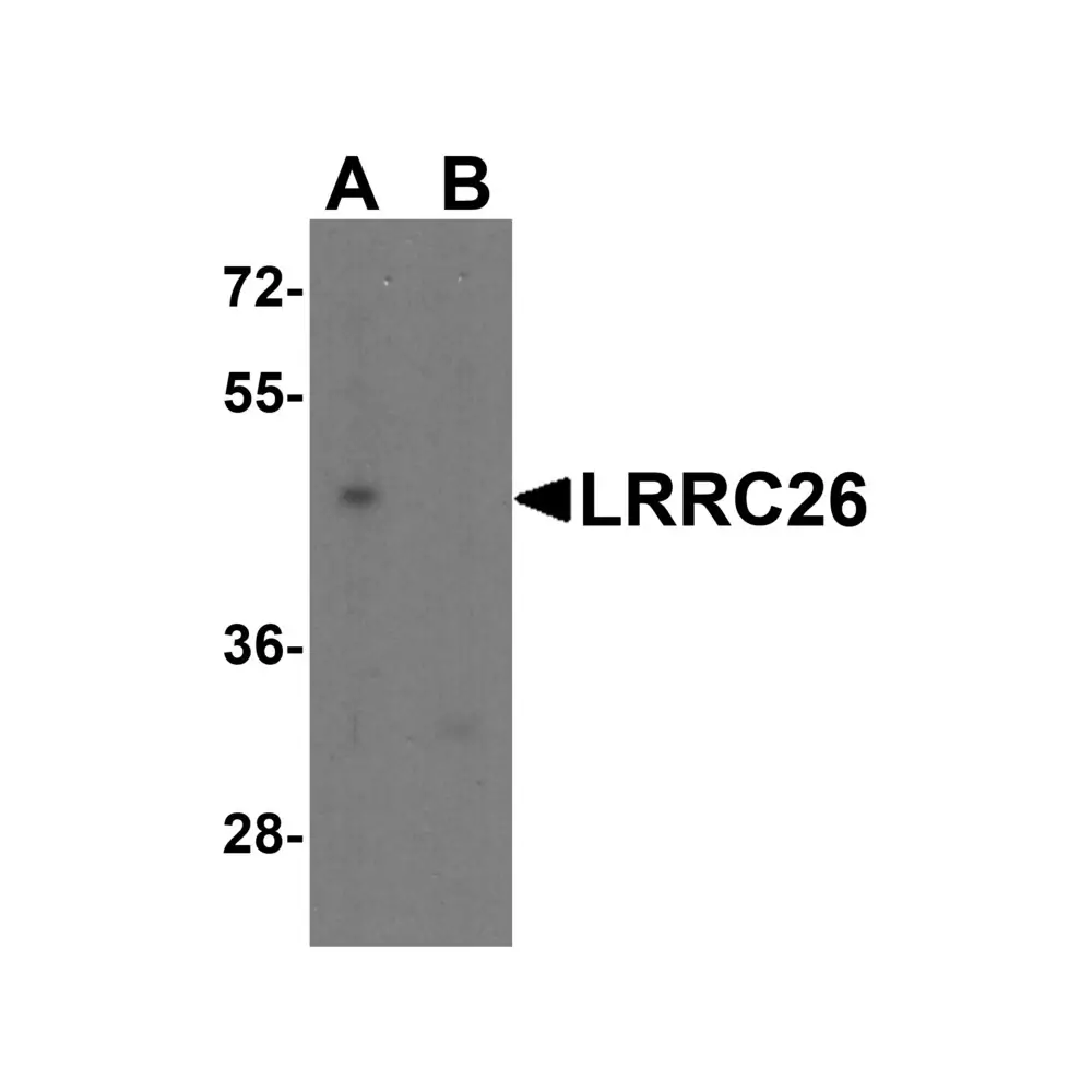 ProSci 7539_S LRRC26 Antibody, ProSci, 0.02 mg/Unit Quaternary Image