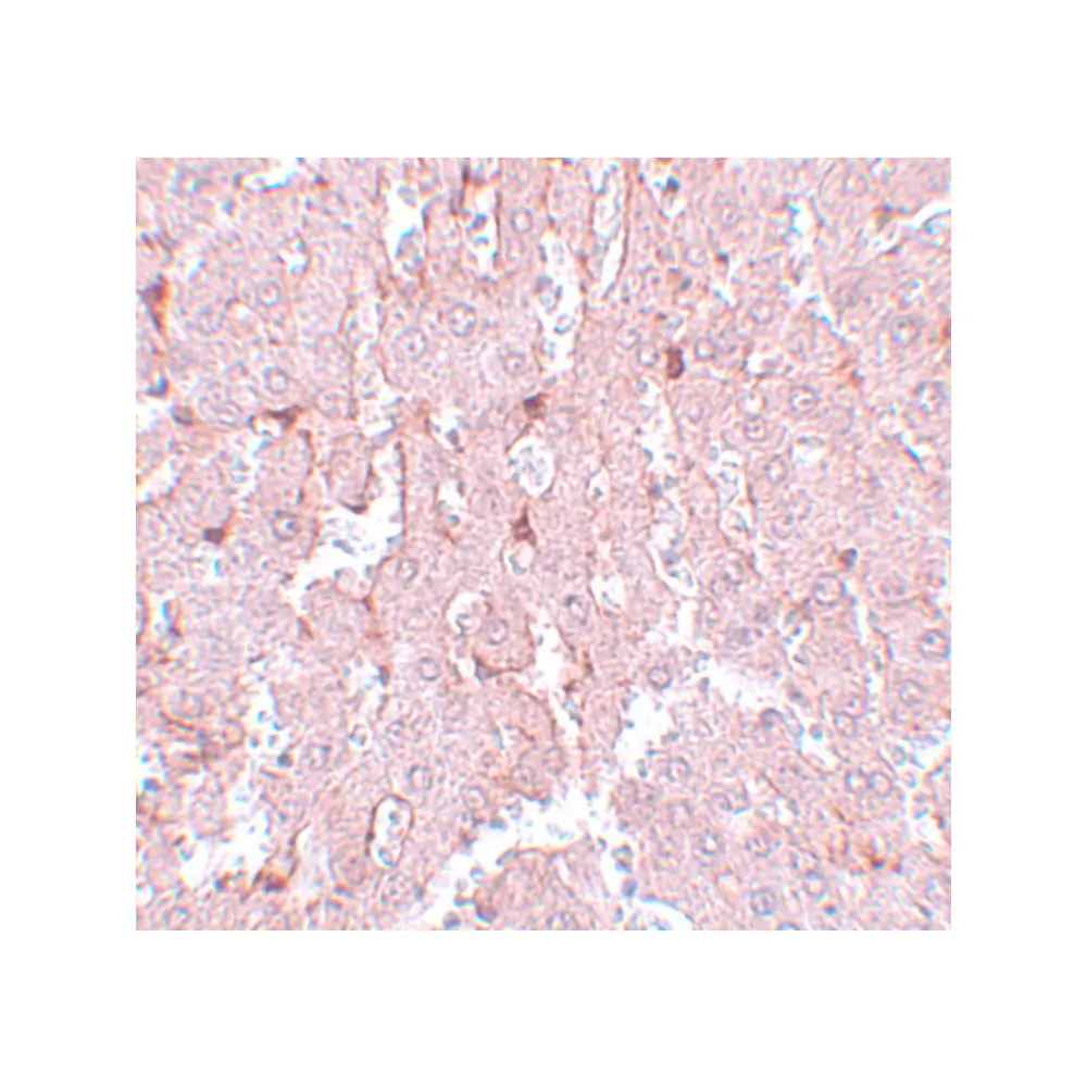 ProSci 5577_S LXR-A Antibody, ProSci, 0.02 mg/Unit Secondary Image