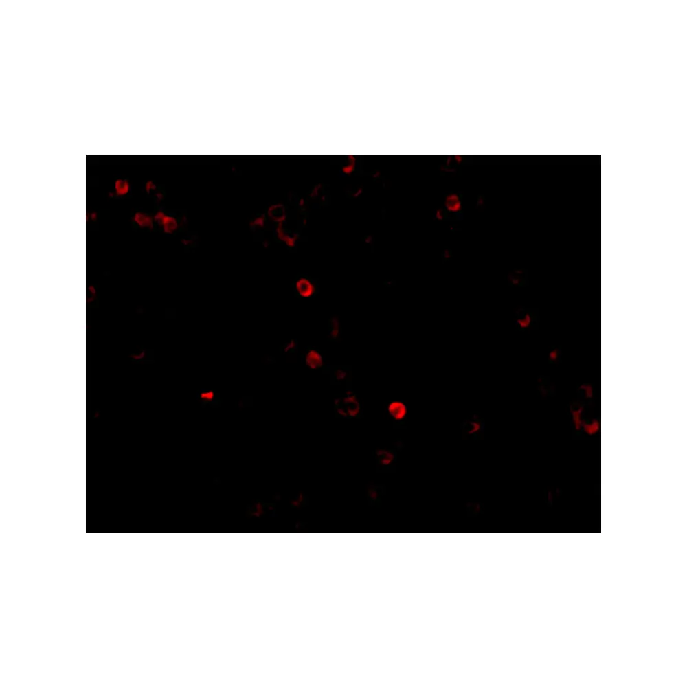 ProSci 4037_S MDA5 Antibody, ProSci, 0.02 mg/Unit Tertiary Image