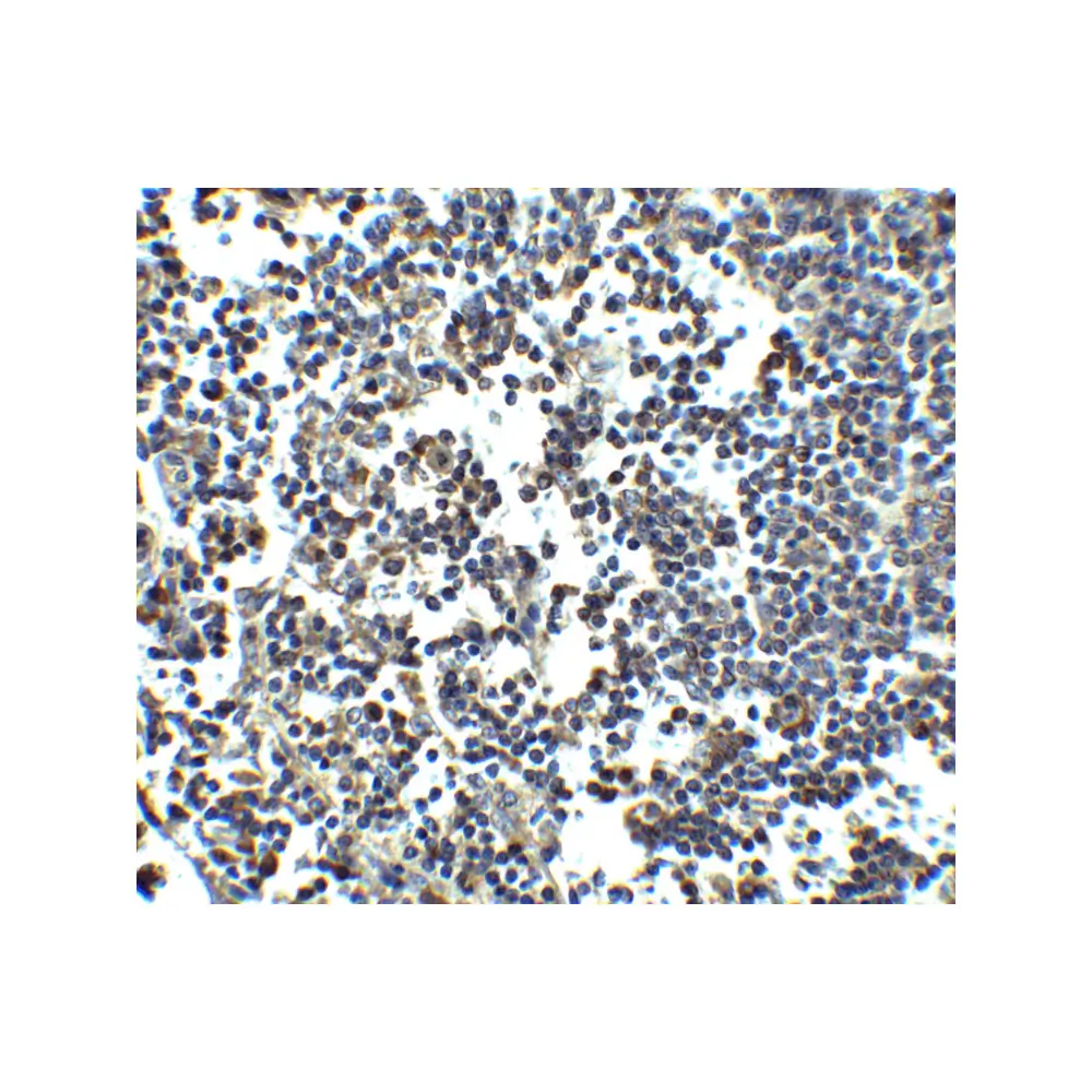 ProSci 4037_S MDA5 Antibody, ProSci, 0.02 mg/Unit Secondary Image