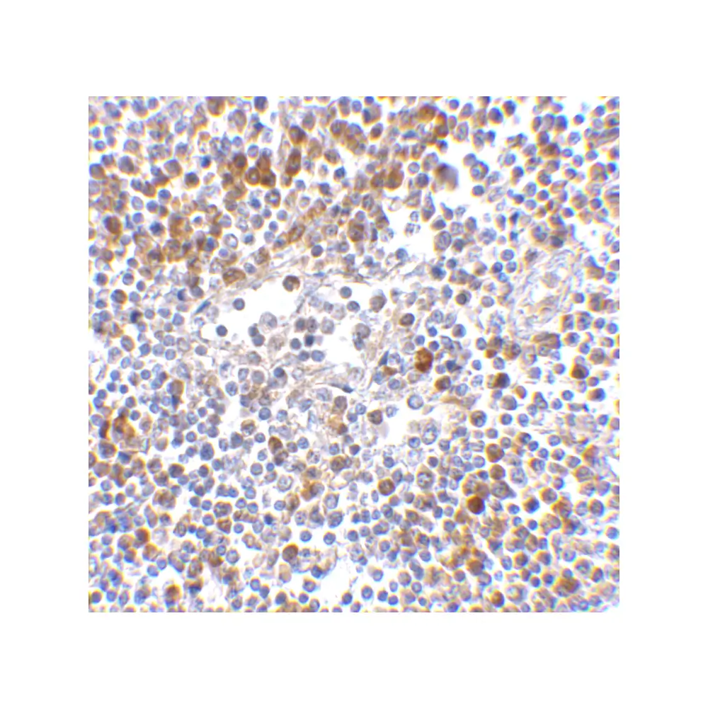 ProSci 4037_S MDA5 Antibody, ProSci, 0.02 mg/Unit Quaternary Image